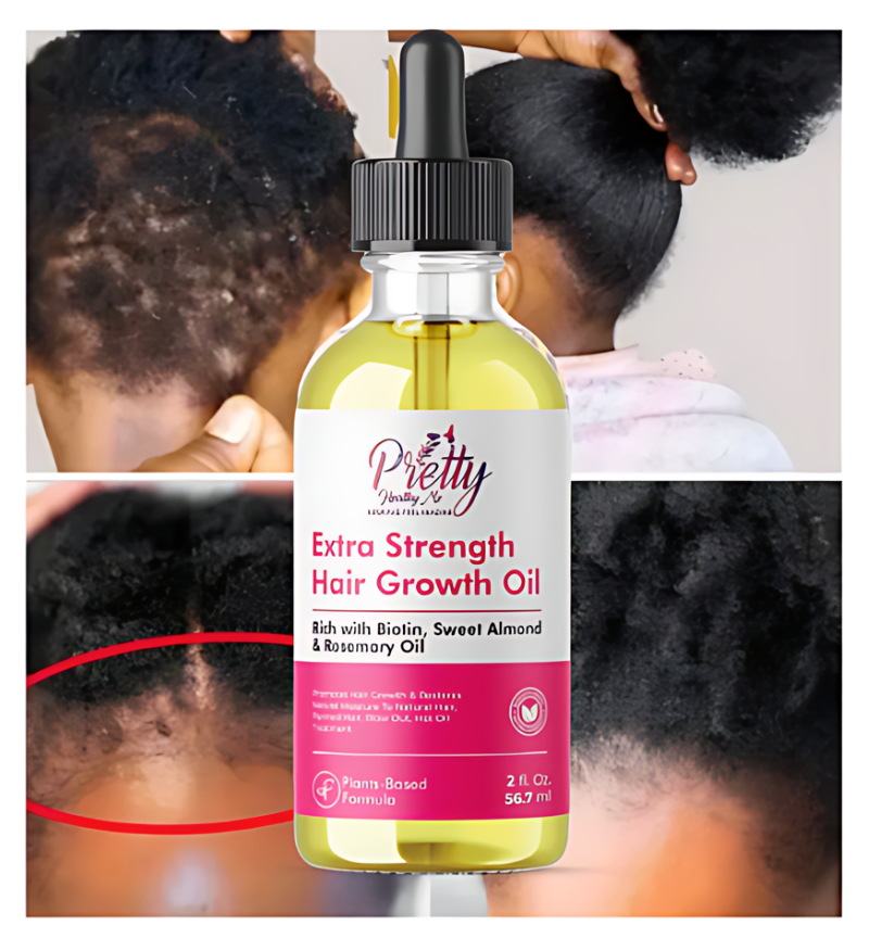 Extra Strength Hair Growth Oil